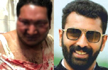 Cafe assault victim discharged from hospital, accused moves to High Court